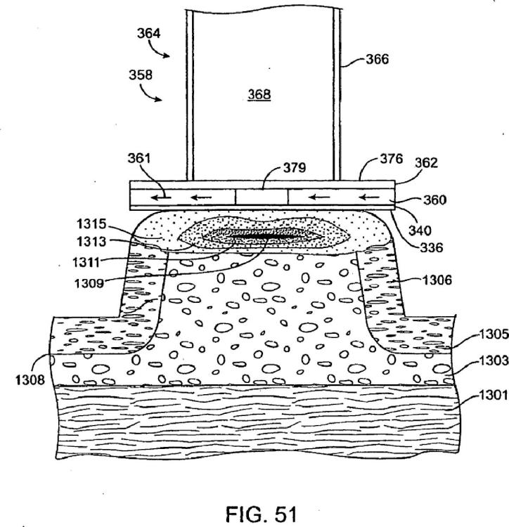 Ilustración 12 de la Galería de ilustraciones de Sistemas para crear un efecto sobre un tejido especificado usando energía de microondas