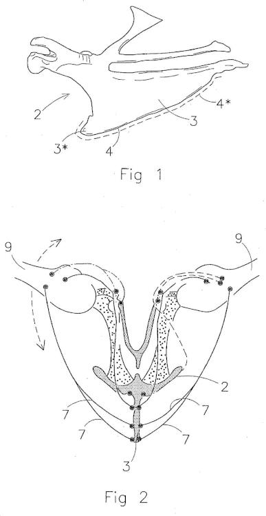 Ilustración 1 de la Galería de ilustraciones de Sistema y método para procesar una parte del cuerpo de aves de corral sacrificadas