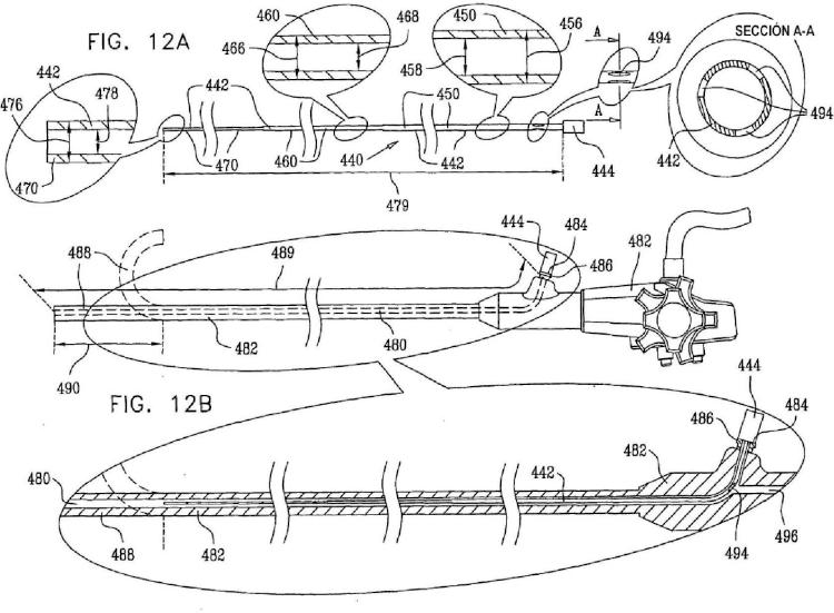 Ilustración 11 de la Galería de ilustraciones de Conjuntos para su uso con endoscopios y aplicaciones de los mismos