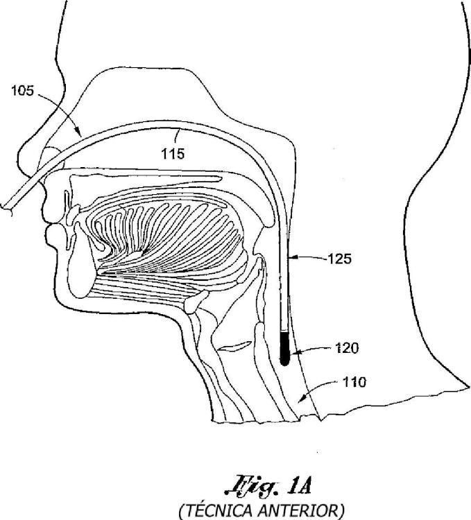 Ilustración 1 de la Galería de ilustraciones de Sonda esofágica flexible de monitorización por Doppler