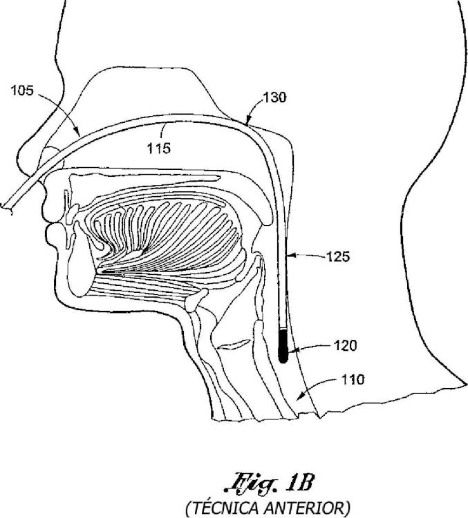 Ilustración 2 de la Galería de ilustraciones de Sonda esofágica flexible de monitorización por Doppler