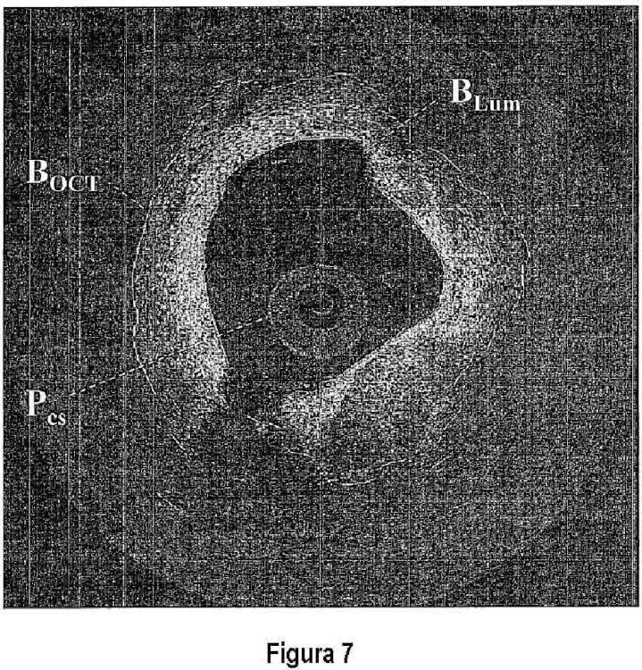 Ilustración 2 de la Galería de ilustraciones de Métodos cuantitativos para obtener características de un tejido a partir de imágenes de tomografía por coherencia óptica