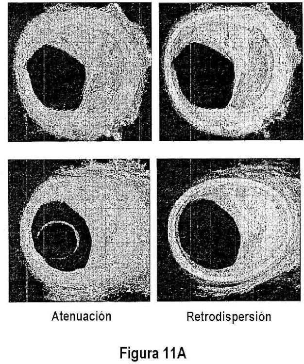 Ilustración 4 de la Galería de ilustraciones de Métodos cuantitativos para obtener características de un tejido a partir de imágenes de tomografía por coherencia óptica
