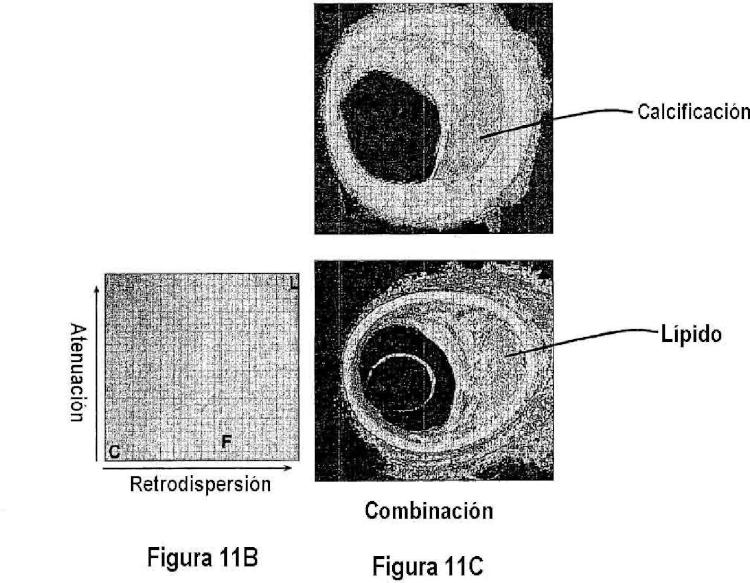 Ilustración 5 de la Galería de ilustraciones de Métodos cuantitativos para obtener características de un tejido a partir de imágenes de tomografía por coherencia óptica