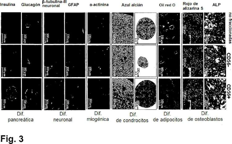 Ilustración 3 de la Galería de ilustraciones de Aislamiento y/o identificación de células madre con potencial de diferenciación adipocitario, condrocitario y pancreático