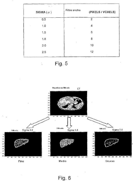 Ilustración 4 de la Galería de ilustraciones de Método, aparato y programa informático para analizar datos de imágenes médicas