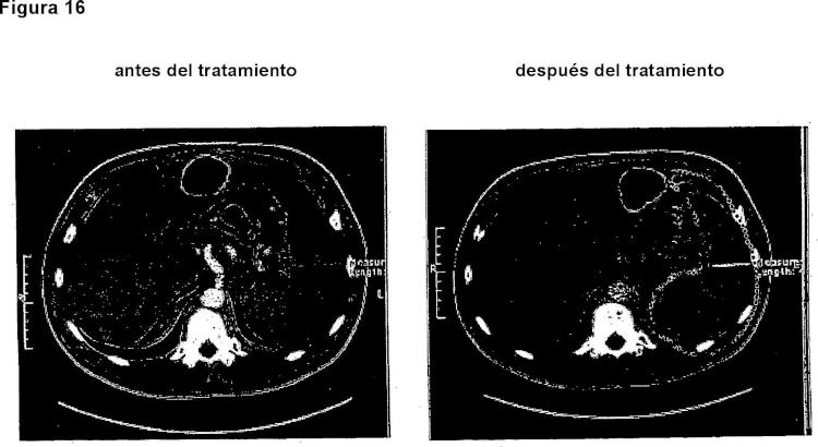 Ilustración 12 de la Galería de ilustraciones de Medios y procedimientos para el tratamiento de enfermedades tumorales