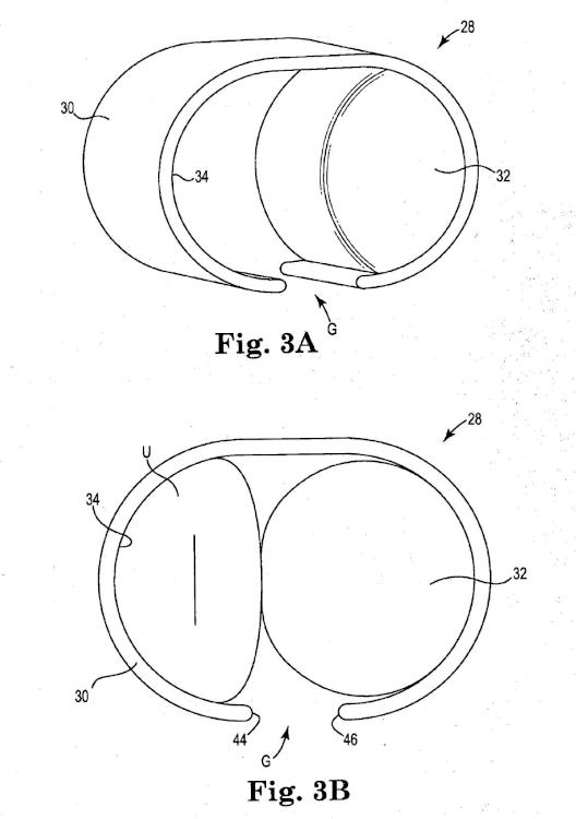 Ilustración 3 de la Galería de ilustraciones de Sistema de esfínter urinario artificial que tiene un manguito con un balón o globo fijado a un bastidor
