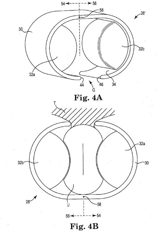 Ilustración 4 de la Galería de ilustraciones de Sistema de esfínter urinario artificial que tiene un manguito con un balón o globo fijado a un bastidor