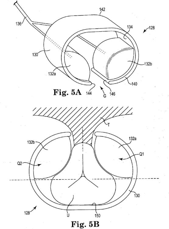 Ilustración 5 de la Galería de ilustraciones de Sistema de esfínter urinario artificial que tiene un manguito con un balón o globo fijado a un bastidor
