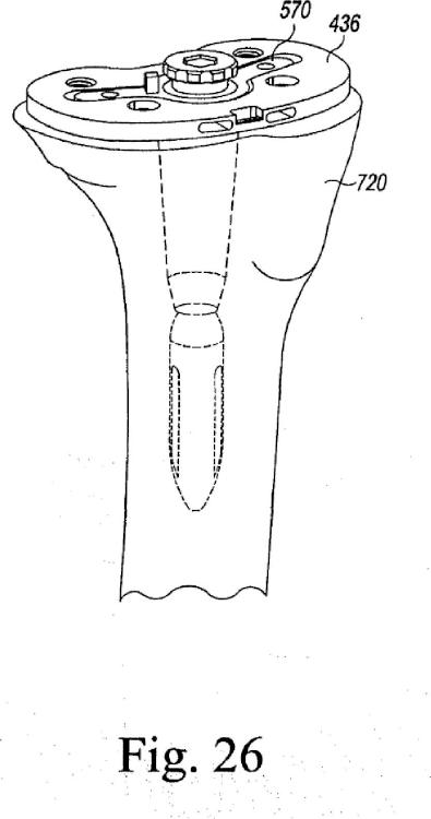 Ilustración 5 de la Galería de ilustraciones de Instrumento de ensayo tibial