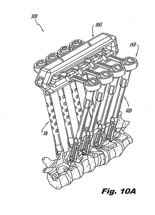 Ilustración 3 de la Galería de ilustraciones de Sistema para realizar cirugía vertebral