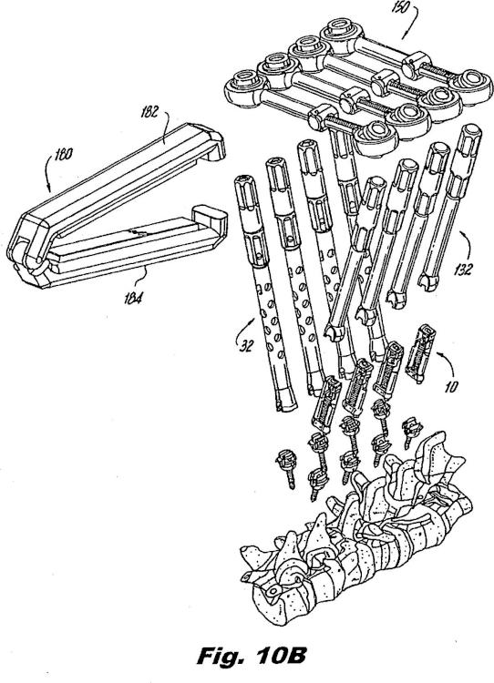 Ilustración 4 de la Galería de ilustraciones de Sistema para realizar cirugía vertebral