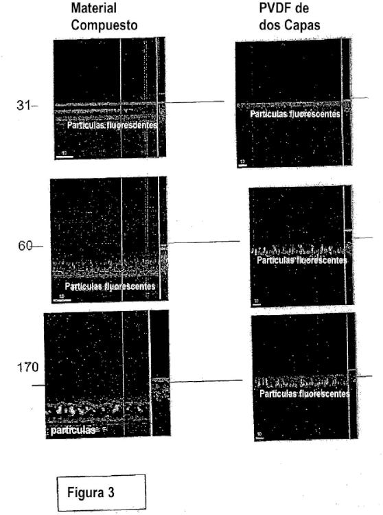 Ilustración 4 de la Galería de ilustraciones de Método para formar membranas de ultrafiltración compuestas de múltiples capas