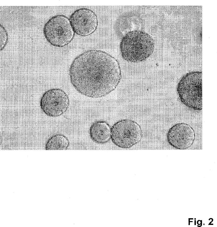 Ilustración 2 de la Galería de ilustraciones de Método para producir células progenitoras retinianas polarizadas a partir de células madre pluripotentes y su diferenciación para dar células del epitelio pigmentario retiniano