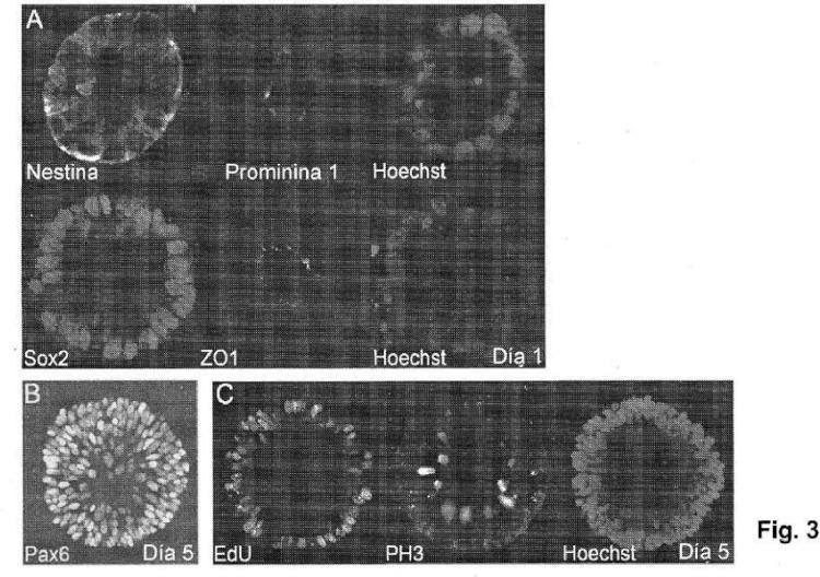 Ilustración 3 de la Galería de ilustraciones de Método para producir células progenitoras retinianas polarizadas a partir de células madre pluripotentes y su diferenciación para dar células del epitelio pigmentario retiniano