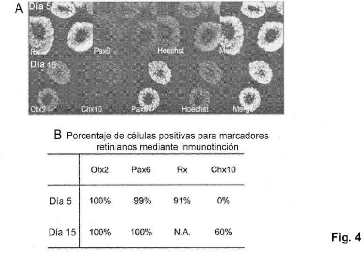 Ilustración 4 de la Galería de ilustraciones de Método para producir células progenitoras retinianas polarizadas a partir de células madre pluripotentes y su diferenciación para dar células del epitelio pigmentario retiniano
