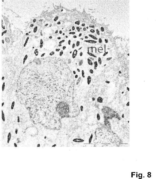 Ilustración 8 de la Galería de ilustraciones de Método para producir células progenitoras retinianas polarizadas a partir de células madre pluripotentes y su diferenciación para dar células del epitelio pigmentario retiniano
