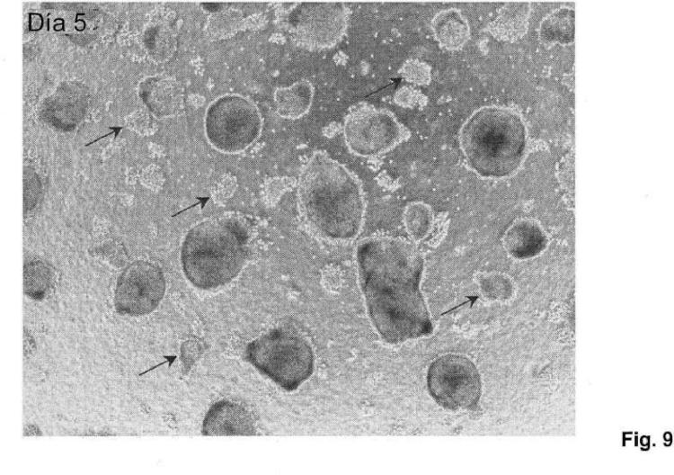 Ilustración 9 de la Galería de ilustraciones de Método para producir células progenitoras retinianas polarizadas a partir de células madre pluripotentes y su diferenciación para dar células del epitelio pigmentario retiniano