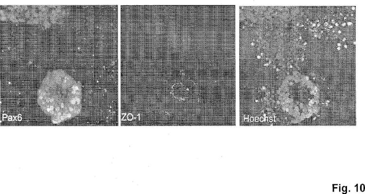 Ilustración 10 de la Galería de ilustraciones de Método para producir células progenitoras retinianas polarizadas a partir de células madre pluripotentes y su diferenciación para dar células del epitelio pigmentario retiniano