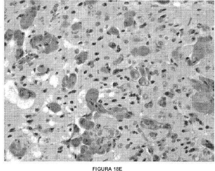 Ilustración 8 de la Galería de ilustraciones de Tratamiento de metástasis cerebrales con inhibidores de los receptores de endotelina en combinación con un agente quimioterapéutico citotóxico