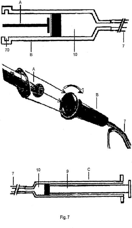 Ilustración 6 de la Galería de ilustraciones de Dispositivo hidráulico de inyección de cemento óseo en vertebroplastia percutánea