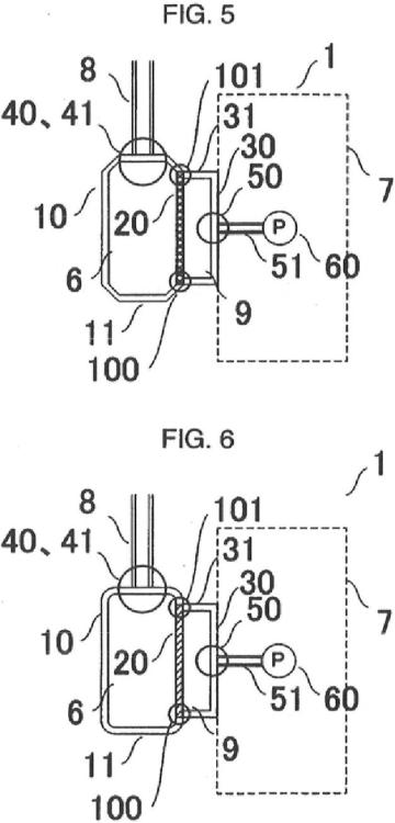 Ilustración 3 de la Galería de ilustraciones de Sensor de presión para circuito de circulación extracorporal