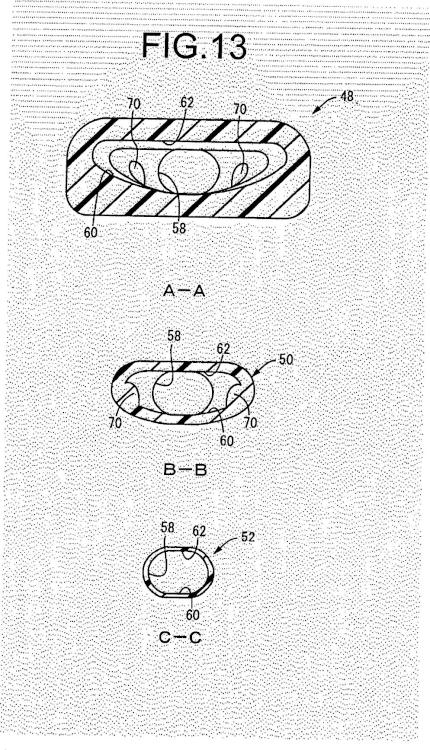 Ilustración 9 de la Galería de ilustraciones de Dispositivo de inserción de lentes intraoculares
