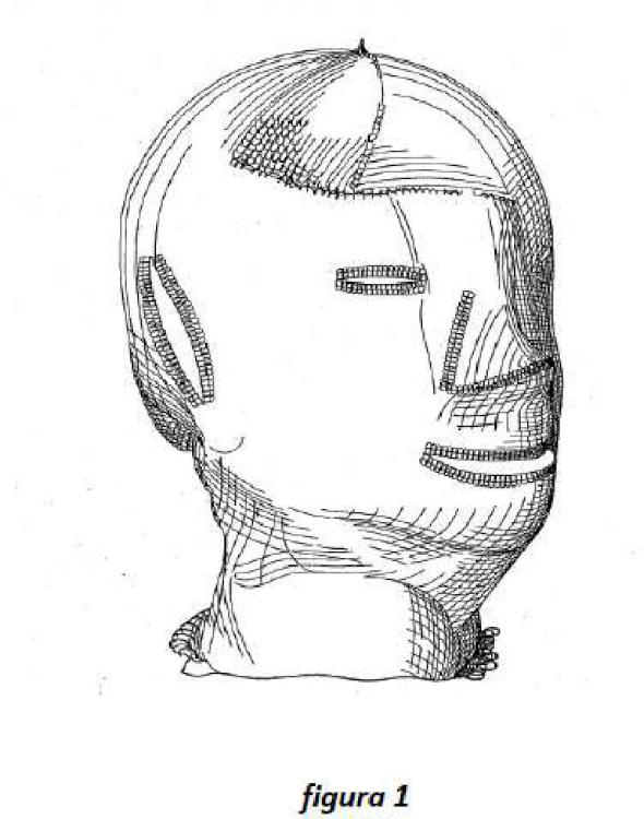 Ilustración 1 de la Galería de ilustraciones de Prenda celulósica carboximetilada como apósito para heridas