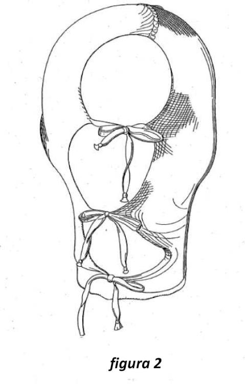 Ilustración 2 de la Galería de ilustraciones de Prenda celulósica carboximetilada como apósito para heridas