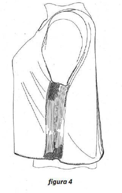 Ilustración 4 de la Galería de ilustraciones de Prenda celulósica carboximetilada como apósito para heridas