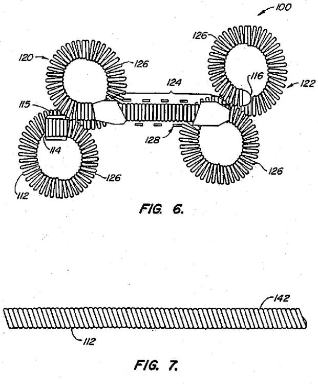 Ilustración 3 de la Galería de ilustraciones de Dispositivos contraconceptivos transcervicales de oclusión de las trompas de Falopio