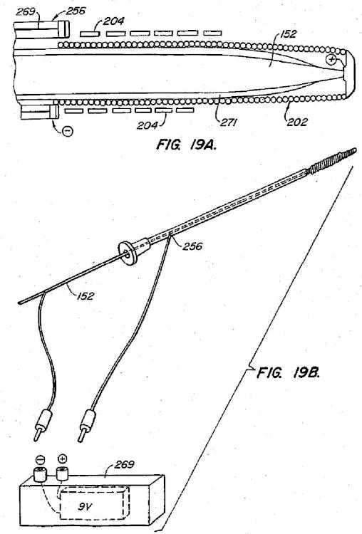 Ilustración 14 de la Galería de ilustraciones de Dispositivos contraconceptivos transcervicales de oclusión de las trompas de Falopio