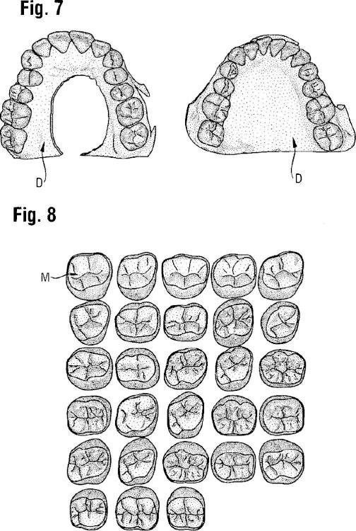 Ilustración 5 de la Galería de ilustraciones de Procedimiento y sistema para la determinación de restauración de dientes para la determinación de restauración de dientes