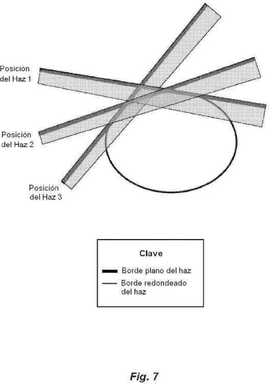 Ilustración 6 de la Galería de ilustraciones de Modelado de radiación mediante rotación coordinada de haces fijos y movimiento del sistema de soporte del paciente