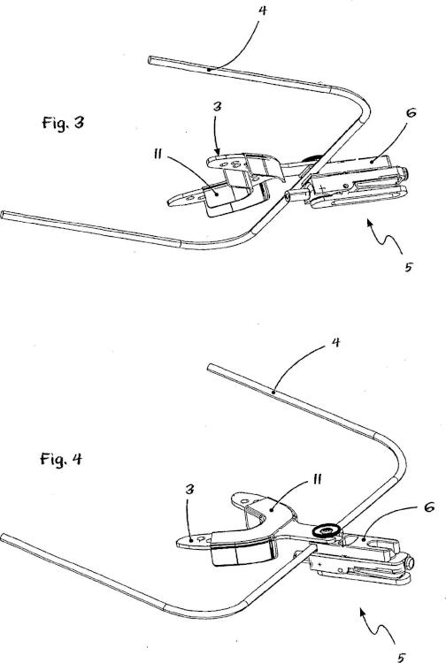 Ilustración 2 de la Galería de ilustraciones de Método y dispositivo para la transferencia referida al eje de bisagra de un modelo de mandíbula