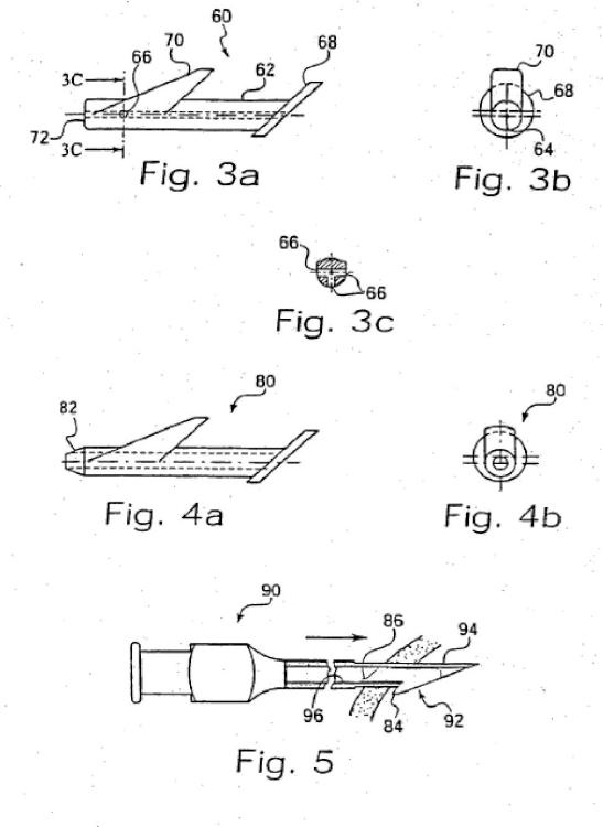 Ilustración 2 de la Galería de ilustraciones de Implante para regular un flujo
