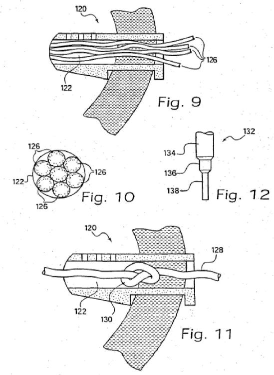 Ilustración 4 de la Galería de ilustraciones de Implante para regular un flujo