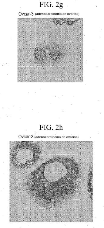 Ilustración 4 de la Galería de ilustraciones de Compuestos de éter de fosfolípido fluorescentes, composiciones y procedimientos de uso