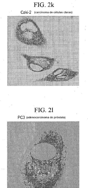 Ilustración 6 de la Galería de ilustraciones de Compuestos de éter de fosfolípido fluorescentes, composiciones y procedimientos de uso