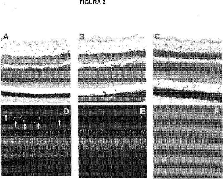 Ilustración 2 de la Galería de ilustraciones de Composiciones para usar en el tratamiento de glaucoma o hipertensión ocular