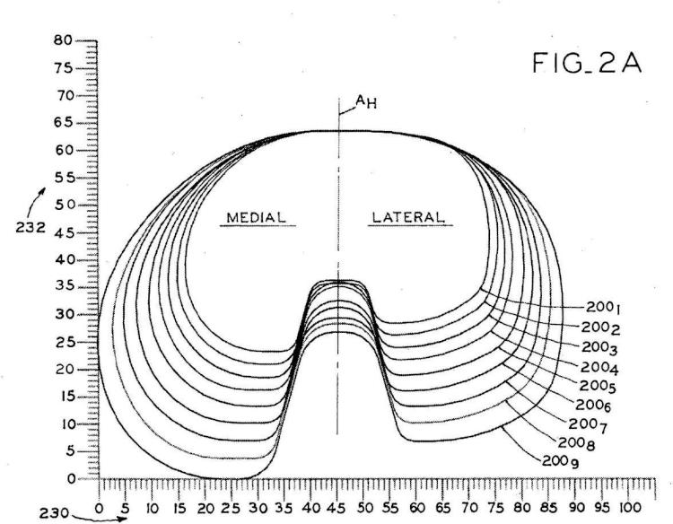 Ilustración 3 de la Galería de ilustraciones de Componentes tibiales asimétricos para una prótesis de rodilla