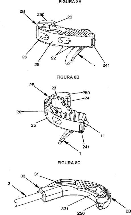 Ilustración 8 de la Galería de ilustraciones de Implante vertebral con dispositivo de anclaje