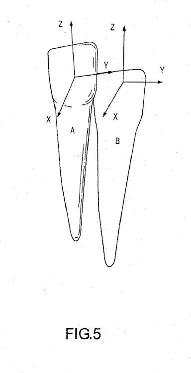 Ilustración 6 de la Galería de ilustraciones de Sistema y procedimiento de modelación de la reducción interproximal de dientes