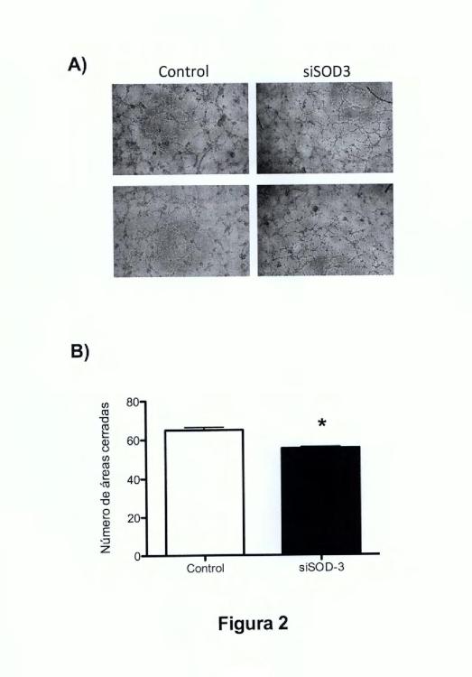 Ilustración 2 de la Galería de ilustraciones de Uso de anticuerpos frente a la enzima SOD-3 para la inhibición del proceso de la angiogénesis y aplicaciones de dichos anticuerpos y de dicha enzima SOD-3
