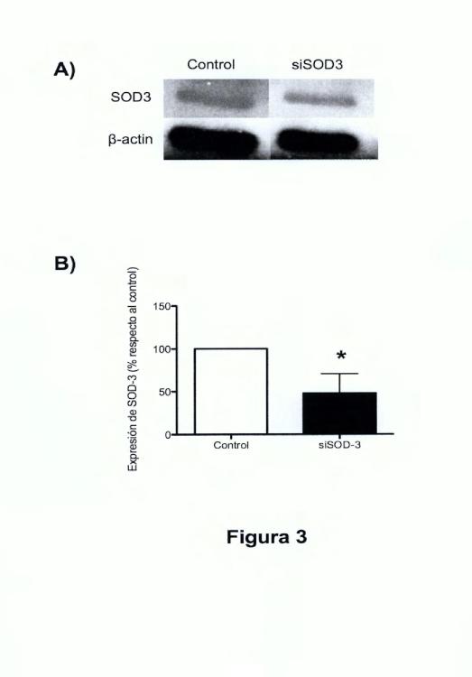 Ilustración 3 de la Galería de ilustraciones de Uso de anticuerpos frente a la enzima SOD-3 para la inhibición del proceso de la angiogénesis y aplicaciones de dichos anticuerpos y de dicha enzima SOD-3