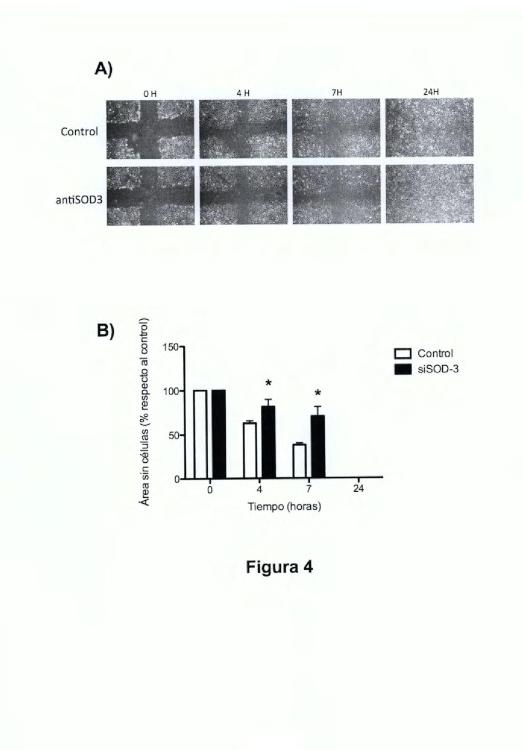 Ilustración 4 de la Galería de ilustraciones de Uso de anticuerpos frente a la enzima SOD-3 para la inhibición del proceso de la angiogénesis y aplicaciones de dichos anticuerpos y de dicha enzima SOD-3