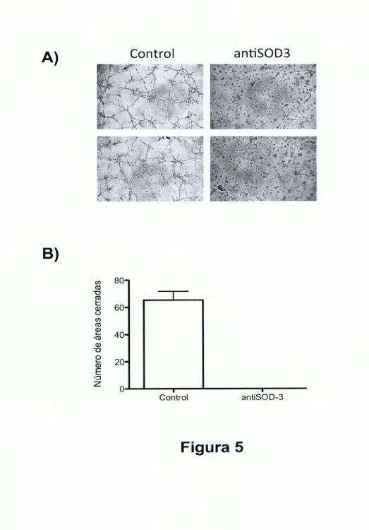 Ilustración 5 de la Galería de ilustraciones de Uso de anticuerpos frente a la enzima SOD-3 para la inhibición del proceso de la angiogénesis y aplicaciones de dichos anticuerpos y de dicha enzima SOD-3