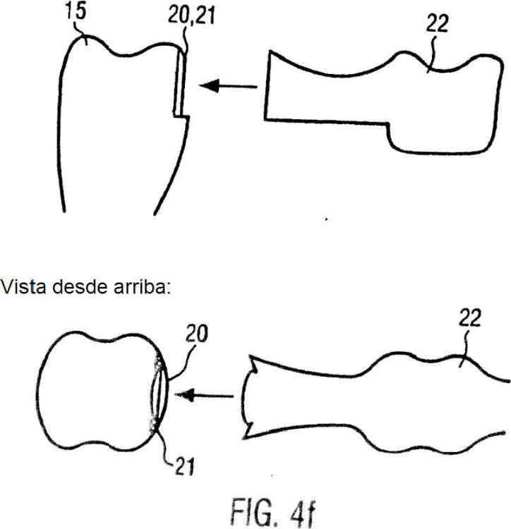 Ilustración 8 de la Galería de ilustraciones de Procedimiento y dispositivo para la producción de una prótesis dental