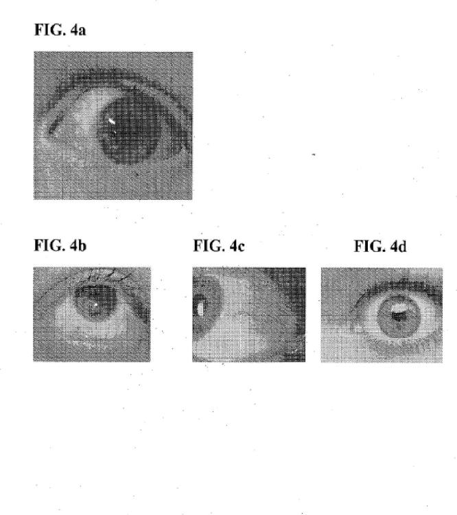 Ilustración 4 de la Galería de ilustraciones de Composiciones y métodos para el blanqueamiento del ojo